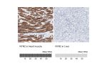 Immunohistochemistry analysis in human heart muscle and liver tissues using HPA020028 antibody. Corresponding RYR2 RNA-seq data are presented for the same tissues.