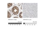 Immunohistochemistry analysis in human testis and liver tissues using HPA020036 antibody. Corresponding PAFAH1B1 RNA-seq data are presented for the same tissues.