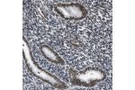 Immunohistochemical staining of human endometrium shows strong nuclear positivity in glandular cells.