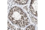 Immunohistochemical staining of human testis shows strong nuclear positivity in cells in seminiferous ducts.
