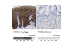 Immunohistochemistry analysis in human esophagus and stomach tissues using HPA020053 antibody. Corresponding TRIM29 RNA-seq data are presented for the same tissues.