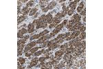 Immunohistochemical staining of human adrenal gland shows moderate granular cytoplasmic positivity in cortical cells.