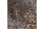 Immunohistochemical staining of human appendix shows strong cytoplasmic positivity in lymphoid tissue.