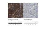Immunohistochemistry analysis in human lymph node and pancreas tissues using HPA020100 antibody. Corresponding PLCG2 RNA-seq data are presented for the same tissues.