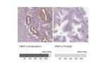 Immunohistochemistry analysis in human endometrium and prostate tissues using HPA020108 antibody. Corresponding PAEP RNA-seq data are presented for the same tissues.