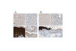 Immunohistochemical staining of human cerebral cortex, liver, skin and testis using Anti-SERPINB5 antibody HPA020136 (A) shows similar protein distribution across tissues to independent antibody HPA019025 (B).