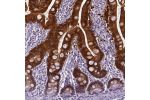 Immunohistochemical staining of human small intestine shows strong cytoplasmic, nuclear and membranous positivity in glandular cells.