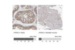 Immunohistochemistry analysis in human testis and skeletal muscle tissues using HPA020339 antibody. Corresponding ATXN2 RNA-seq data are presented for the same tissues.