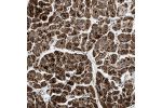 Immunohistochemical staining of human heart muscle shows strong granular cytoplasmic positivity in cardiomyocytes.