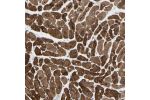 Immunohistochemical staining of human heart shows strong cytoplasmic positivity in cardiomyocytes.