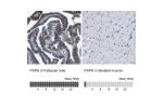 Immunohistochemistry analysis in human fallopian tube and skeletal muscle tissues using HPA020376 antibody. Corresponding PSPH RNA-seq data are presented for the same tissues.