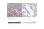 Immunohistochemistry analysis in human ovary and prostate tissues using Anti-MUM1L1 antibody. Corresponding MUM1L1 RNA-seq data are presented for the same tissues.
