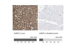 Immunohistochemistry analysis in human liver and skeletal muscle tissues using HPA020549 antibody. Corresponding SHMT2 RNA-seq data are presented for the same tissues.
