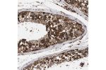Immunohistochemical staining of human testis shows strong cytoplasmic positivity in cells in seminiferous ducts.