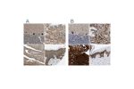 Immunohistochemical staining of human cerebellum, prostate, skeletal muscle and skin using Anti-BAG3 antibody HPA020586 (A) shows similar protein distribution across tissues to independent antibody HPA018493 (B).