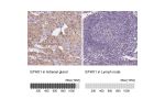 Immunohistochemistry analysis in human adrenal gland and lymph node tissues using Anti-EPHX1 antibody. Corresponding EPHX1 RNA-seq data are presented for the same tissues.