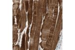 Immunohistochemical staining of human skeletal muscle shows cytoplasmic positivity in myocytes.