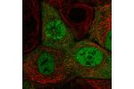 Immunofluorescent staining of human cell line A-431 shows localization to nucleoplasm & cytosol.