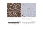 Immunohistochemistry analysis in human liver and skeletal muscle tissues using HPA020734 antibody. Corresponding AASS RNA-seq data are presented for the same tissues.