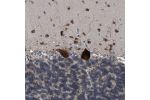 Immunohistochemical staining of human cerebellum shows strong cytoplasmic positivity in Purkinje cells.