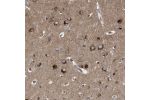 Immunohistochemical staining of human cerebral cortex shows strong cytoplasmic positivity in neurons.