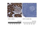Immunohistochemistry analysis in human kidney and lymph node tissues using HPA020896 antibody. Corresponding ASS1 RNA-seq data are presented for the same tissues.