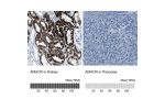 Immunohistochemistry analysis in human kidney and pancreas tissues using Anti-AMACR antibody. Corresponding AMACR RNA-seq data are presented for the same tissues.