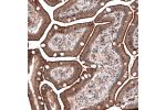 Immunohistochemical staining of human duodenum shows both membranous and nuclear positivity in glandular cells.