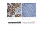 Immunohistochemistry analysis in human kidney and lymph node tissues using HPA020934 antibody. Corresponding ASS1 RNA-seq data are presented for the same tissues.