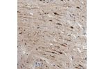 Immunohistochemical staining of human cerebral cortex shows strong positivity in neurons.