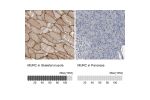 Immunohistochemistry analysis in human skeletal muscle and pancreas tissues using Anti-MURC antibody. Corresponding MURC RNA-seq data are presented for the same tissues.