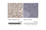 Immunohistochemistry analysis in human skeletal muscle and pancreas tissues using Anti-MURC antibody. Corresponding MURC RNA-seq data are presented for the same tissues.