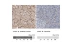 Immunohistochemistry analysis in human skeletal muscle and liver tissues using Anti-MURC antibody. Corresponding MURC RNA-seq data are presented for the same tissues.