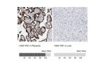 Immunohistochemistry analysis in human placenta and prostate tissues using Anti-HSD17B1 antibody. Corresponding HSD17B1 RNA-seq data are presented for the same tissues.