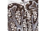 Immunohistochemical staining of human colon shows strong cytoplasmic positivity in glandular cells.