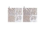 Immunohistochemical staining of human colon, kidney, liver and testis using Anti-SGPL1 antibody HPA021125 (A) shows similar protein distribution across tissues to independent antibody HPA023086 (B).