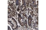 Immunohistochemical staining of human duodenum shows strong positivity in glandular cells.