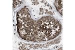 Immunohistochemical staining of human testis shows strong cytoplasmic positivity in cells of seminiferus ducts.