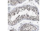 Immunohistochemical staining of human testis shows strong nuclear positivity in cells in seminiferous ducts.