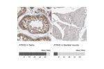Immunohistochemistry analysis in human testis and skeletal muscle tissues using HPA021146 antibody. Corresponding ATXN2 RNA-seq data are presented for the same tissues.