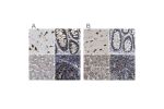 Immunohistochemical staining of human cerebral cortex, colon, liver and lymph node using Anti-EBAG9 antibody HPA021154 (A) shows similar protein distribution across tissues to independent antibody HPA021153 (B).