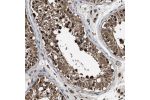 Immunohistochemical staining of human testis shows strong cytoplasmic and nuclear positivity in cells in seminiferous ducts.