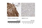 Immunohistochemistry analysis in human skeletal muscle and liver tissues using HPA021186 antibody. Corresponding OBSCN RNA-seq data are presented for the same tissues.