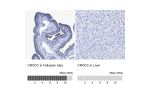 Immunohistochemistry analysis in human fallopian tube and liver tissues using HPA021191 antibody. Corresponding CROCC RNA-seq data are presented for the same tissues.