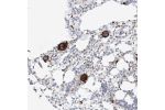 Immunohistochemical staining of human bone marrow shows strong cytoplasmic and membrane positivity in bone marrow poietic cells.