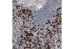 Immunohistochemical staining of human spleen shows strong cytoplasmic positivity in cells of red pulp.