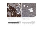 Immunohistochemistry analysis in human kidney and pancreas tissues using Anti-NQO2 antibody. Corresponding NQO2 RNA-seq data are presented for the same tissues.
