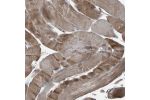 Immunohistochemical staining of human skeletal muscle shows moderate cytoplasmic positivity in myocytes.
