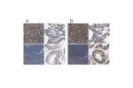 Immunohistochemistry analysis in human liver and pancreas tissues using Anti-HSD17B4 antibody. Corresponding HSD17B4 RNA-seq data are presented for the same tissues.