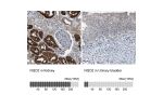 Immunohistochemistry analysis in human kidney and urinary bladder tissues using HPA021332 antibody. Corresponding NQO2 RNA-seq data are presented for the same tissues.